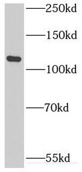 INTS3 Rabbit Polyclonal Antibody