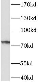 IVL Rabbit Polyclonal Antibody
