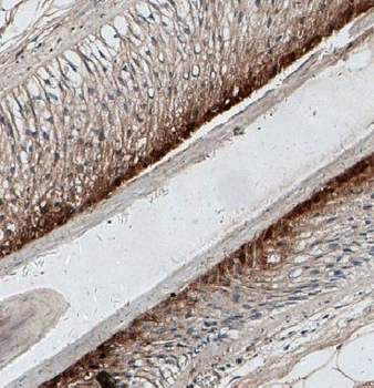 IVL Rabbit Polyclonal Antibody