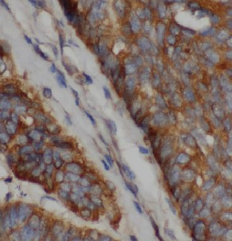 IQGAP2 Rabbit Polyclonal Antibody