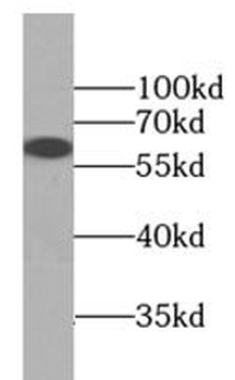 IRF2BP2 Rabbit Polyclonal Antibody