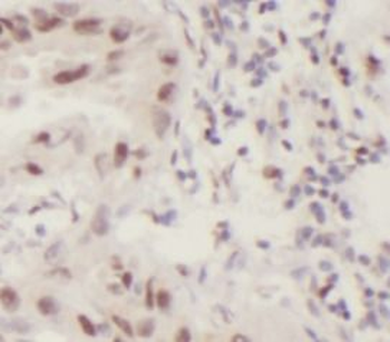 IRF2BP2 Rabbit Polyclonal Antibody