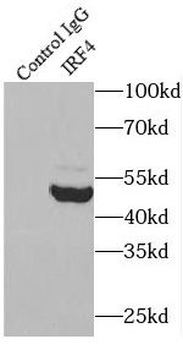IRF4 Antibody