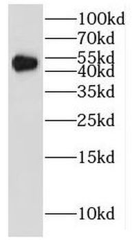 IRF5 Rabbit Polyclonal Antibody