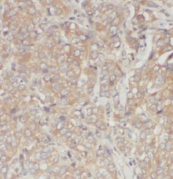 IRF5 Rabbit Polyclonal Antibody