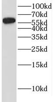 IRF6 Rabbit Polyclonal Antibody