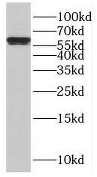 ISYNA1 Rabbit Polyclonal Antibody