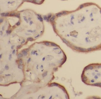 ITM2A Rabbit Polyclonal Antibody