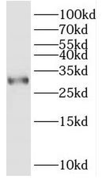 ITM2C Rabbit Polyclonal Antibody