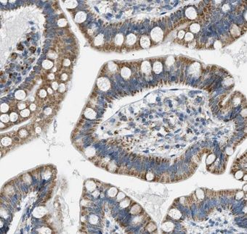 ITM2C Rabbit Polyclonal Antibody