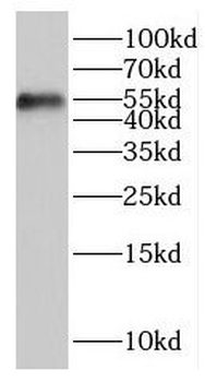 ITPKA Rabbit Polyclonal Antibody