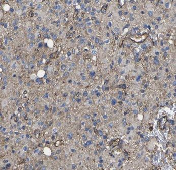 ITPKA Rabbit Polyclonal Antibody