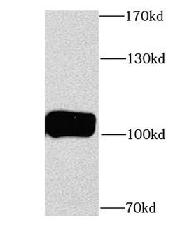 ITPKB Rabbit Polyclonal Antibody