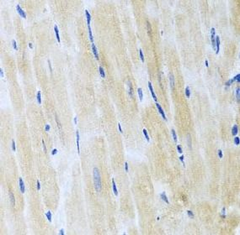 ITPKB Rabbit Polyclonal Antibody