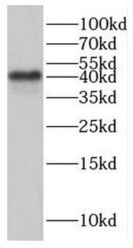 IVD Rabbit Polyclonal Antibody