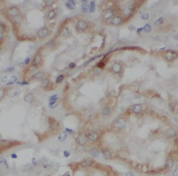 IVNS1ABP Rabbit Polyclonal Antibody