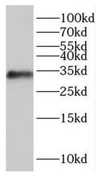 IYD Rabbit Polyclonal Antibody