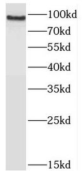 JAKMIP2 Antibody