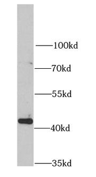 JMJD6 Rabbit Polyclonal Antibody