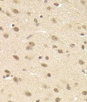 JMJD6 Rabbit Polyclonal Antibody