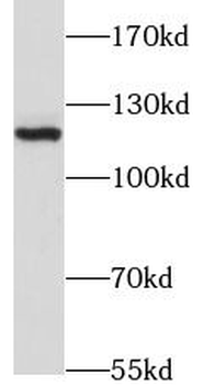 JMY Rabbit Polyclonal Antibody