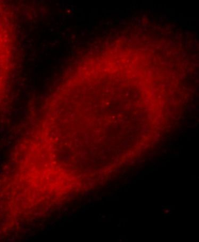 JMY Rabbit Polyclonal Antibody