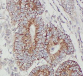 JMY Rabbit Polyclonal Antibody