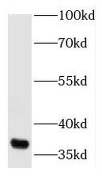 AIMP2 Rabbit Polyclonal Antibody