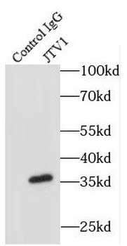 AIMP2 Rabbit Polyclonal Antibody