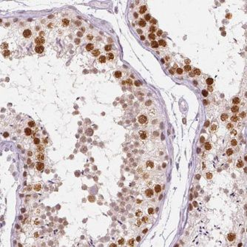 AIMP2 Rabbit Polyclonal Antibody