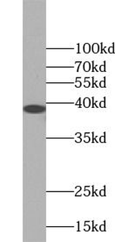 JUN Rabbit Polyclonal Antibody