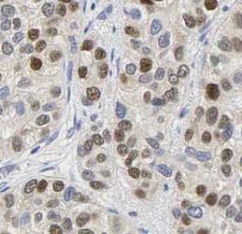 JUN Rabbit Polyclonal Antibody