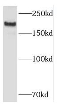 KALRN Rabbit Polyclonal Antibody