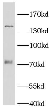 KANK1 Rabbit Polyclonal Antibody