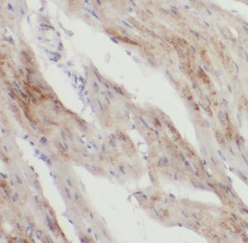 KANK1 Rabbit Polyclonal Antibody