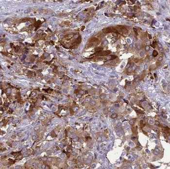 KARS1 Rabbit Polyclonal Antibody