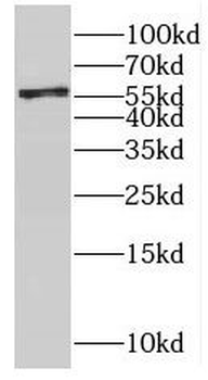 KATNA1 Rabbit Polyclonal Antibody