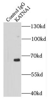 KATNA1 Rabbit Polyclonal Antibody