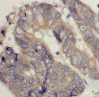 KAZN Rabbit Polyclonal Antibody