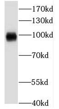 KCNC4 Rabbit Polyclonal Antibody