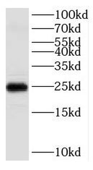 KCNIP1 Rabbit Polyclonal Antibody