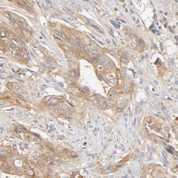 KCNIP1 Rabbit Polyclonal Antibody