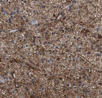 KCNIP3 Antibody