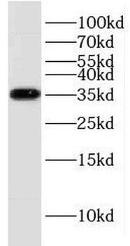 KCNJ15 Rabbit Polyclonal Antibody