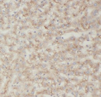 KCNJ15 Rabbit Polyclonal Antibody