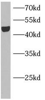 KCNJ5 Rabbit Polyclonal Antibody