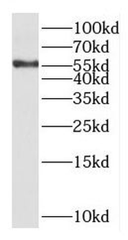 KCNV1 Rabbit Polyclonal Antibody