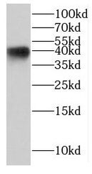 KCTD12 Rabbit Polyclonal Antibody