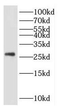 KCTD5 Rabbit Polyclonal Antibody