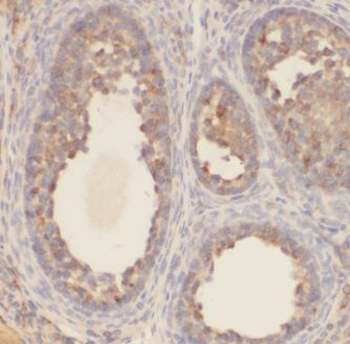KCTD5 Rabbit Polyclonal Antibody